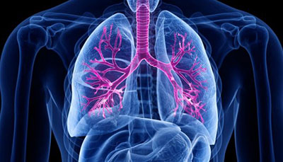 什么是慢性阻塞性肺病 (Chronic Obstructive Pulmonary Disease)，為何與新冠疫情有關(guān)？